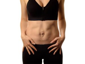 La verdad sobre el core y la diastasis de recto abdominal
